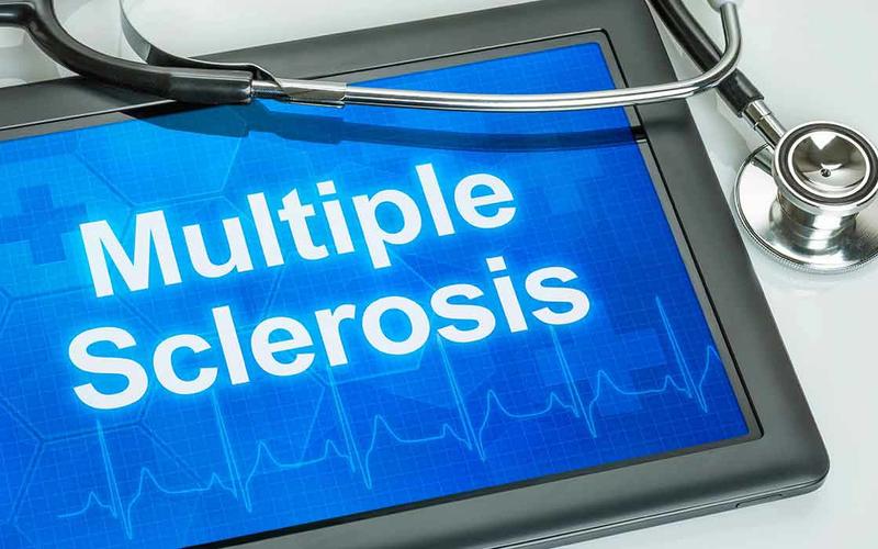 Multiple Sclerosis