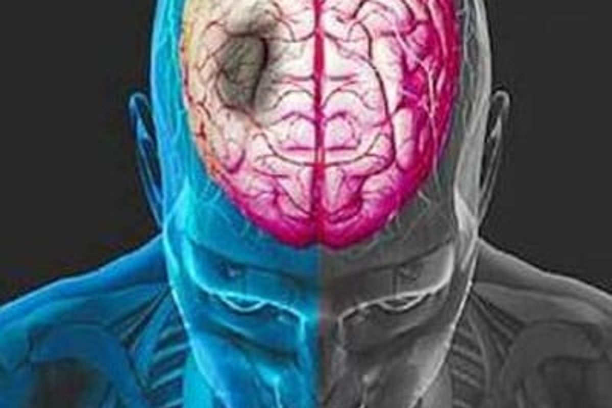 An illustration of an internal brain injury.