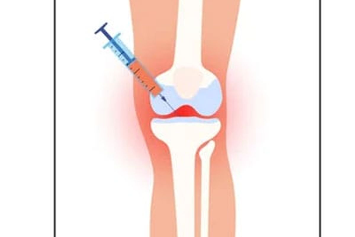 Image depicting joint injection.