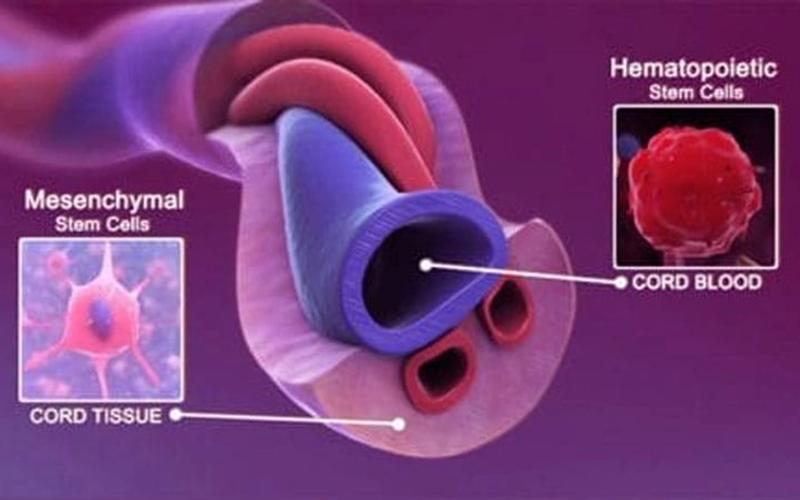 Regenerative Medicine for Autoimmune Conditions