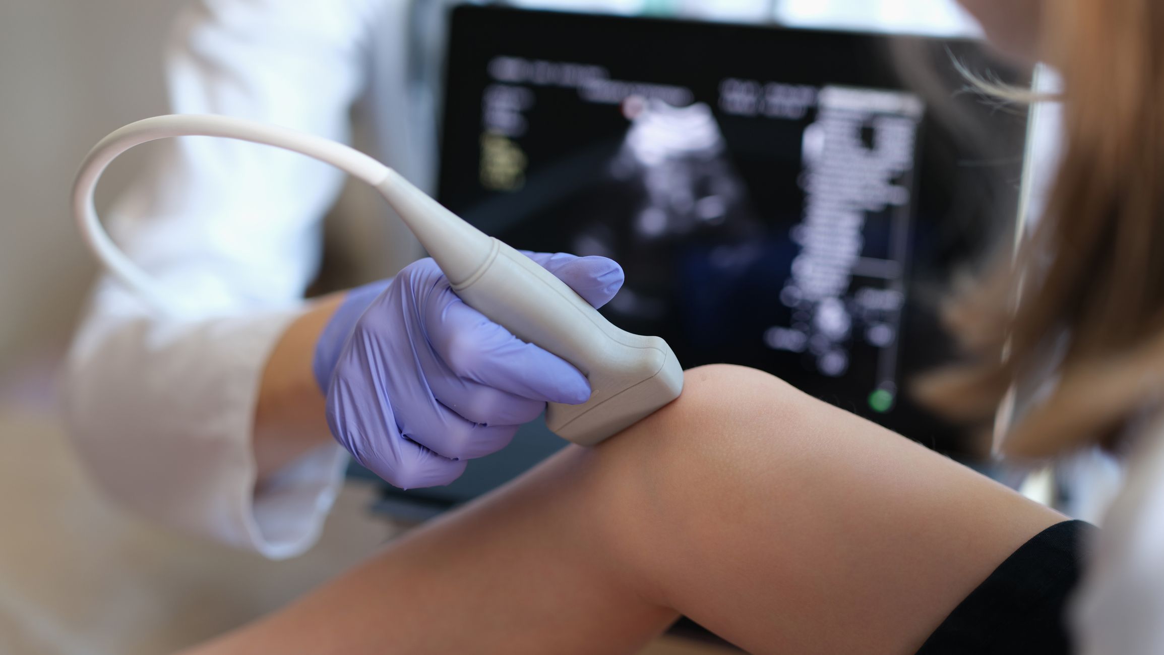  Exosome therapy shows great potential in the treatment of osteoarthritis