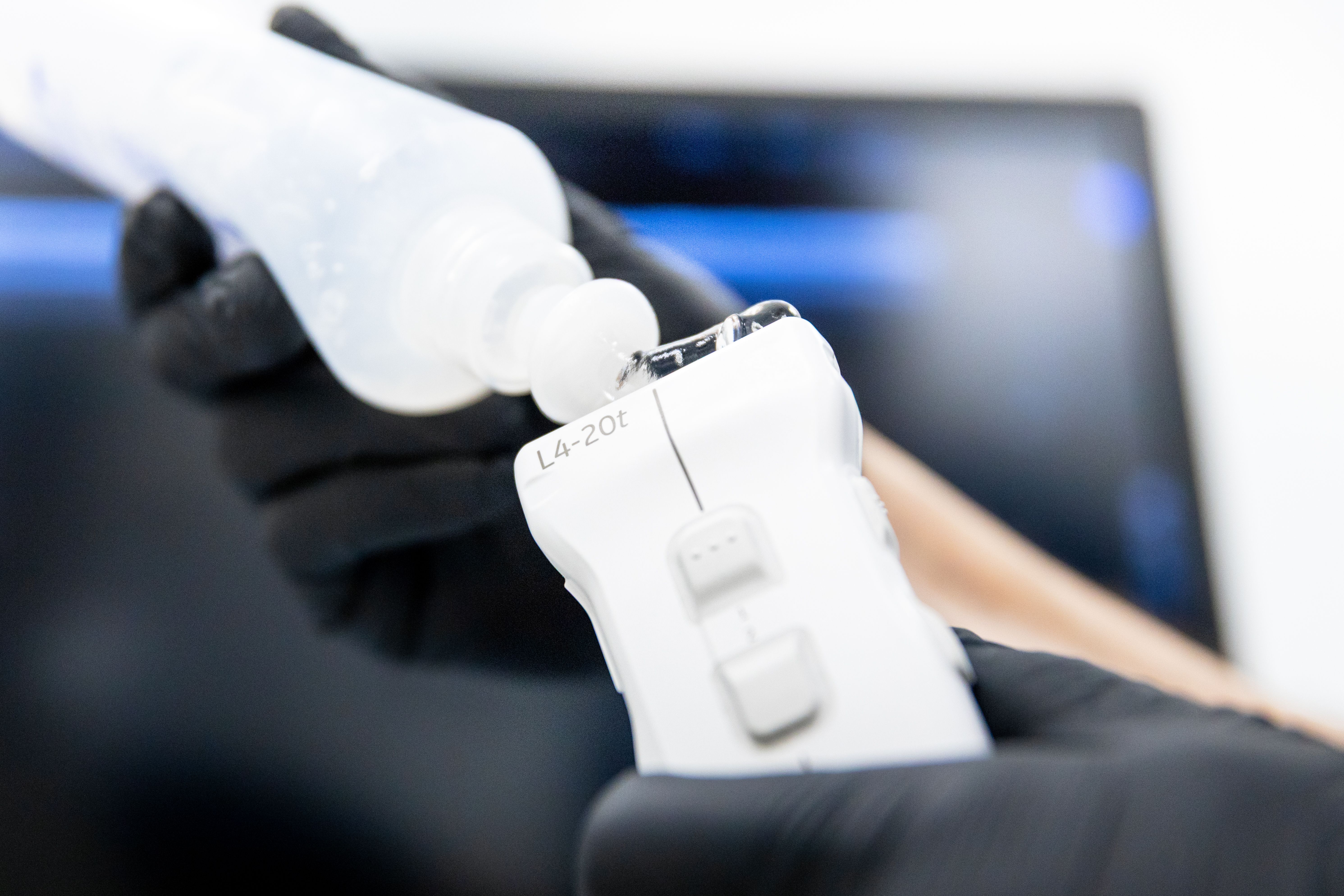 Exosombehandling visar stor potential vid behandling av artros.