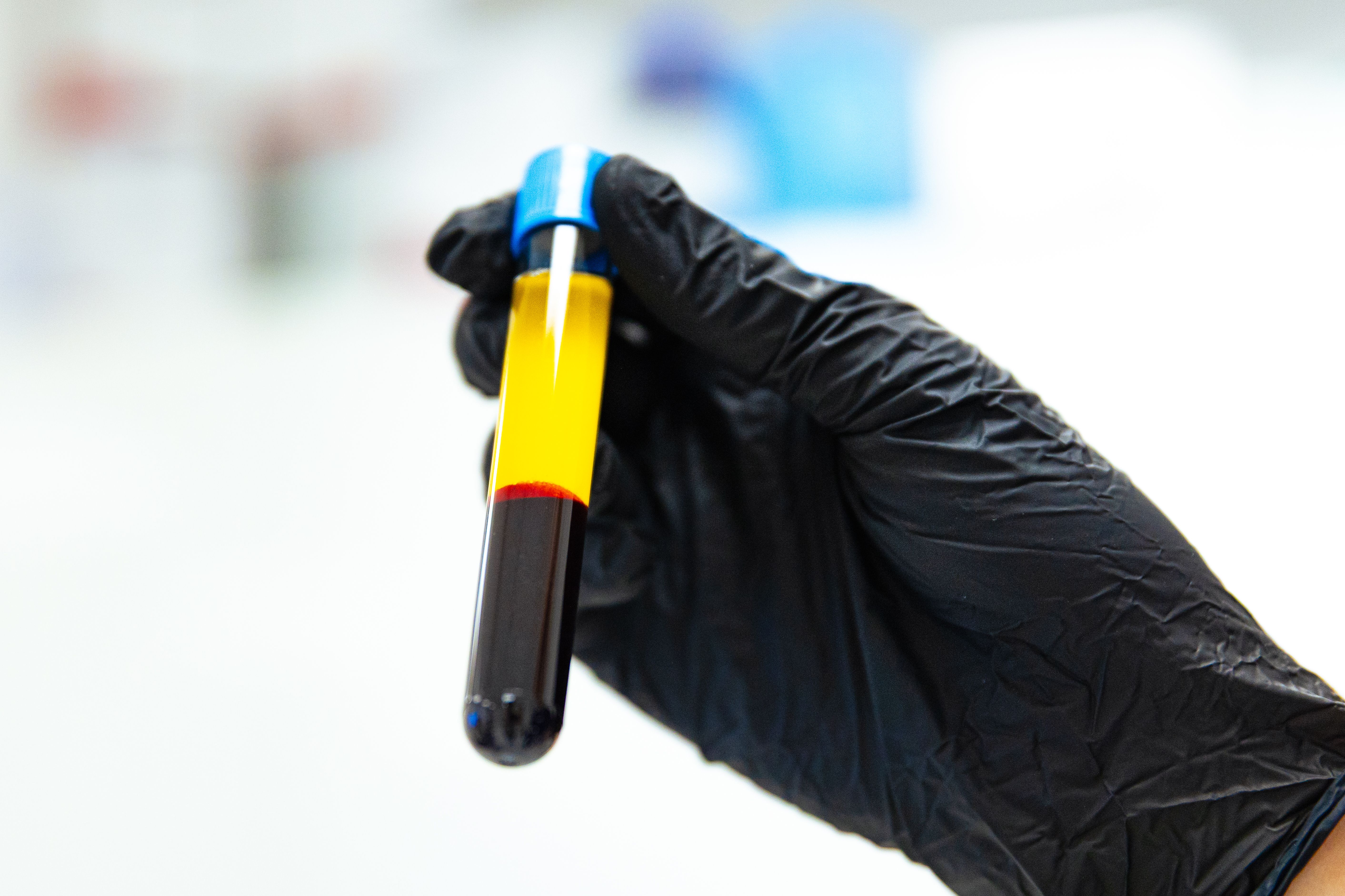 Naturlig läkning med kroppens egna celler