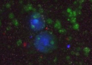 Embryonala kroppar (EBs) från SPSCs