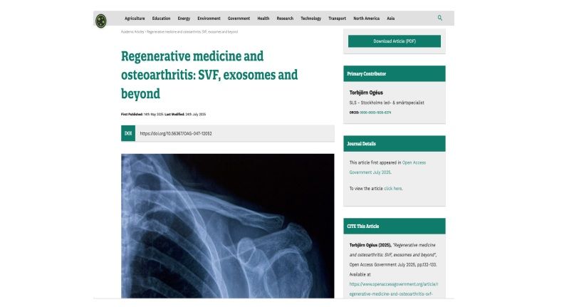 Regenerative medicine and osteoarthritis: SVF, exosomes and beyond