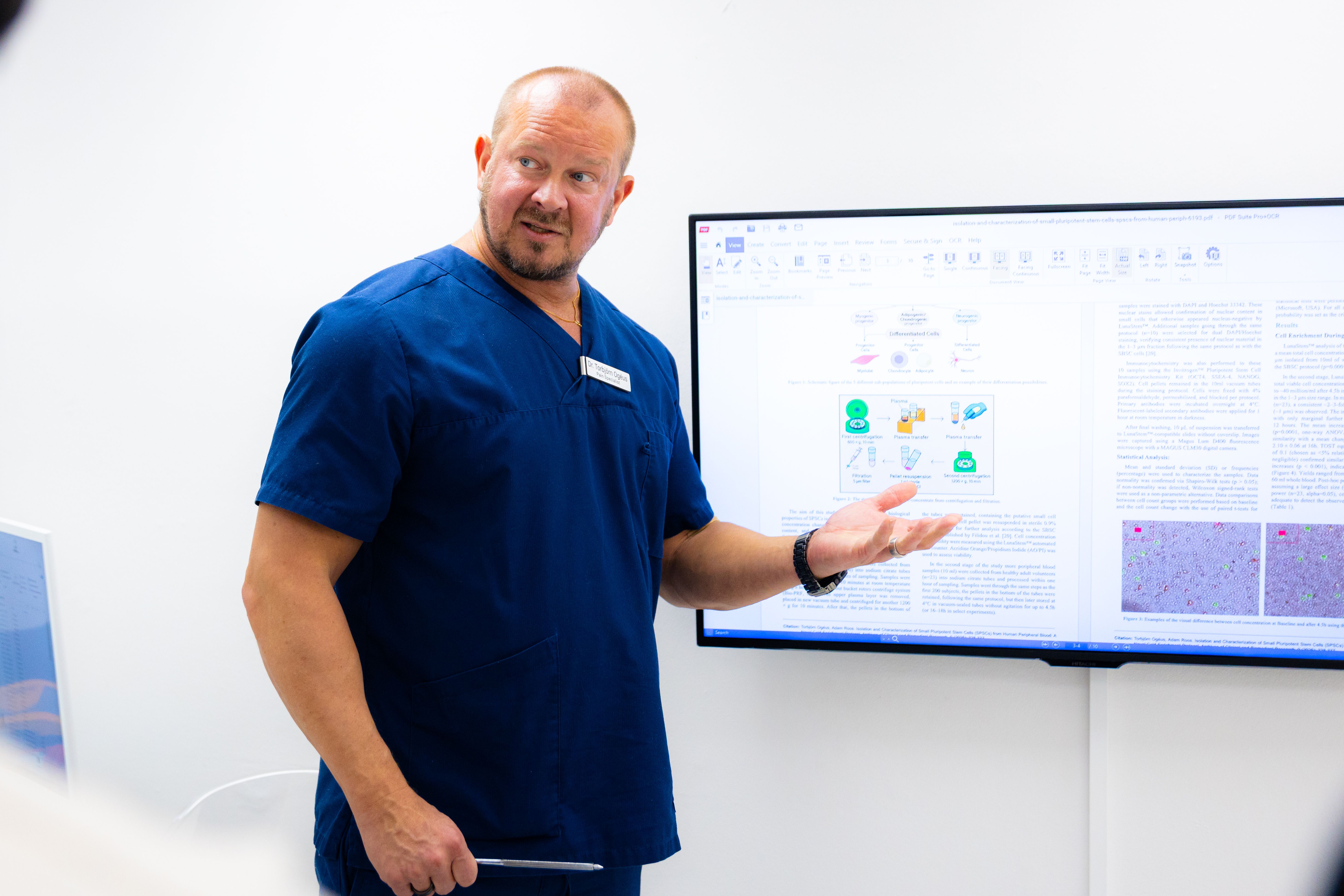 Lovande effekter vid kombination av stamceller och exosomer med hydrogel.