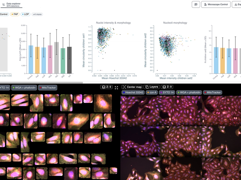 Multiplex Imaging Analysis