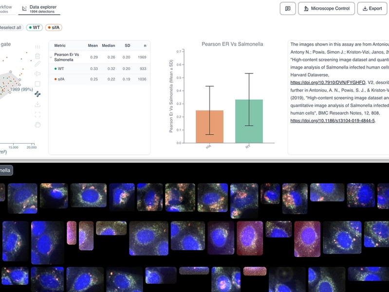 Protein Co-localization - Salmonella and ER Membrane