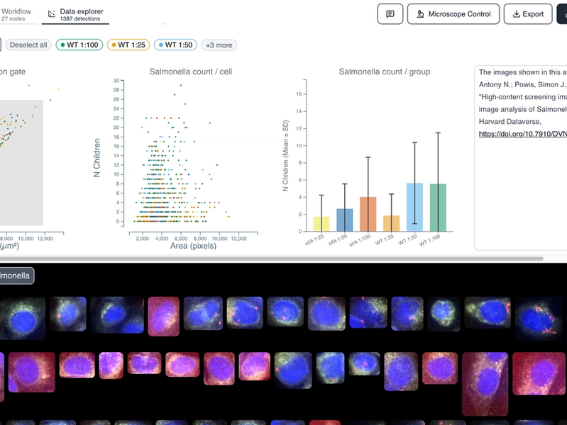 Bacteria Internalization - Salmonella Infected HeLa Cells