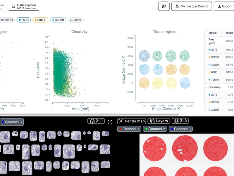 Tissue Cellularity Quantification - Nuclei Counting in Tissue Sections