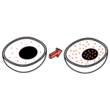 Nuclear Translocation