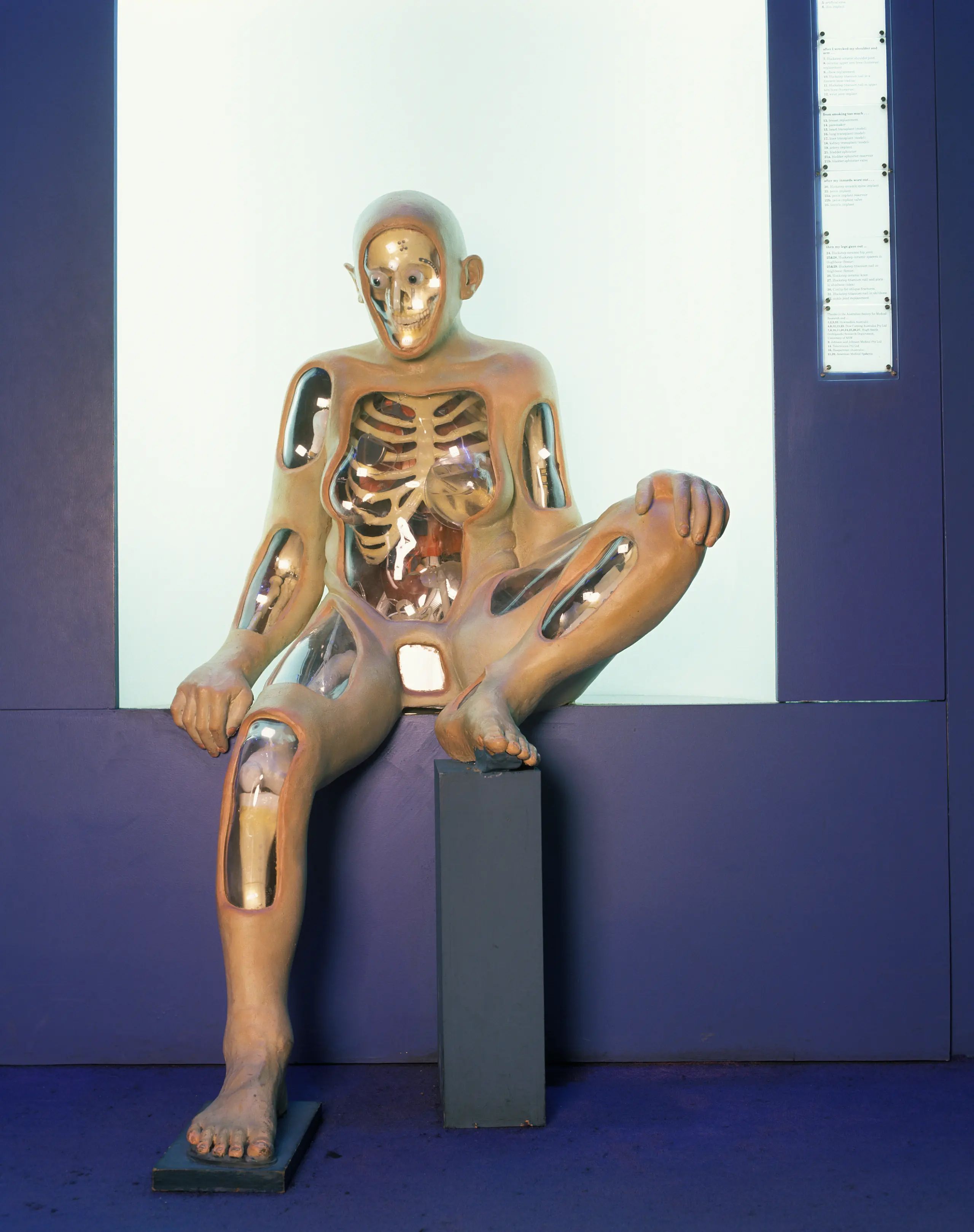 Photograph of 'Chocka Bits', a life-size mannequin of an adult in a seated position. Inside the mannequin an artificial skeleton, 28 artificial surgical implants, and four model organs