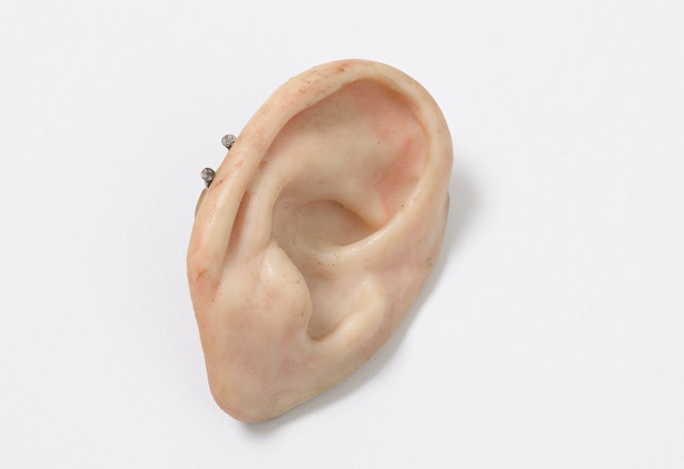 A human ear prosthesis for the right side of the head, coloured pink.There are two metal pins in the side of the ear.