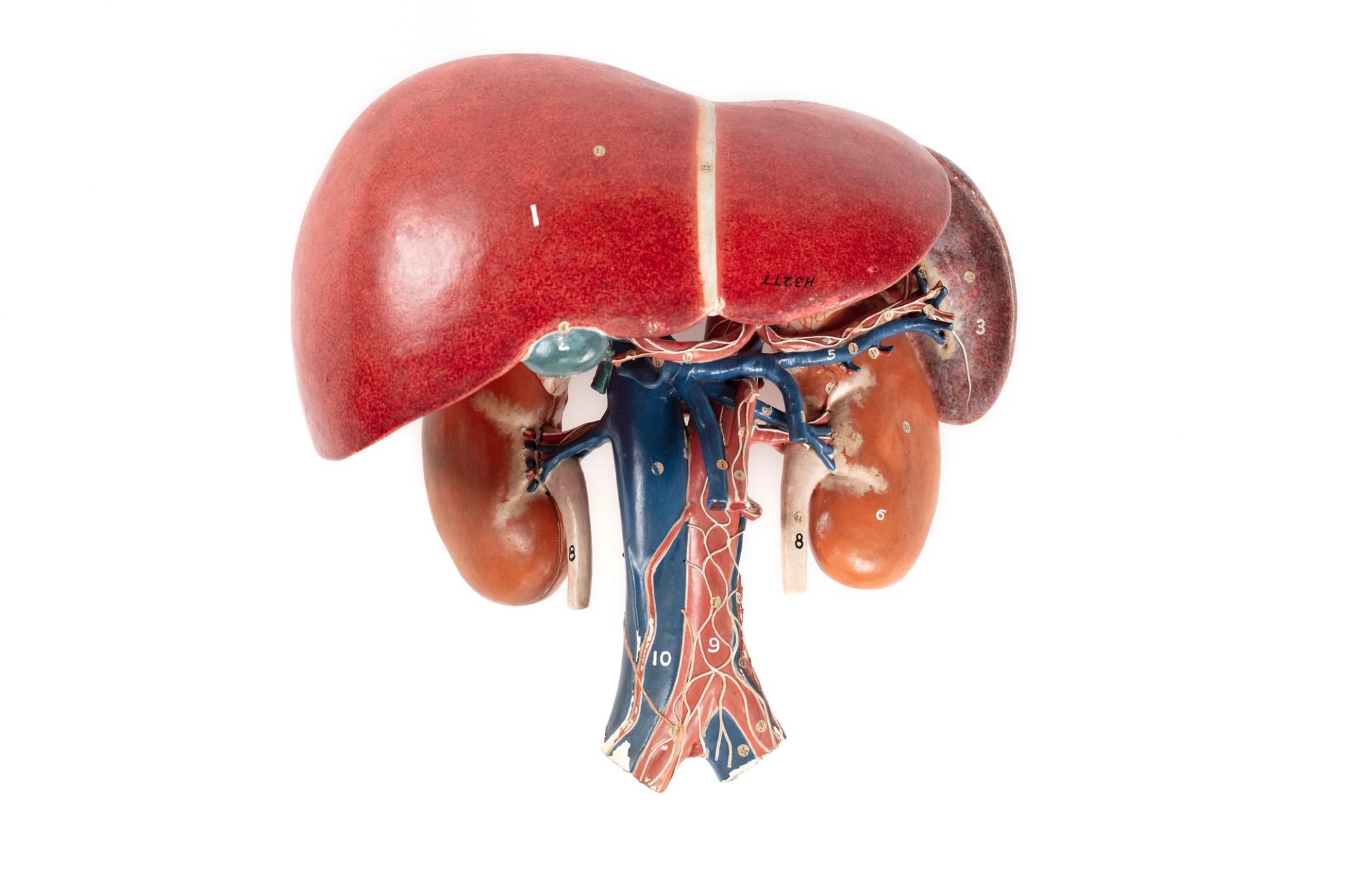 Anatomical model of the left and right kidney, liver and spleen, made of plaster and papier-mâché. The model is painted brown to indicate the kidneys, mottled red, purple and white for the spleen and bright red with white lines for the liver. Connecting these organs together are red and blue blood vessels and the aorta.