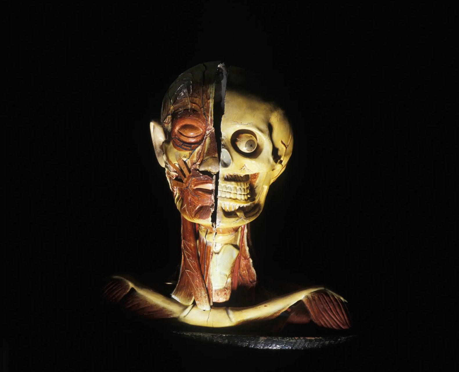 Anatomical model of a human head and shoulders made of painted plaster and papier-mâché and mounted on an oval wooden base. The model shows a bisected head. One side shows the muscles, veins and nerves with a closed eye and skin covered ear, while the other side shows the skeletal structure including eyeball and teeth, with roots and nerves. Both sides of the neck and shoulders show the collar bone with muscles and veins. There are two cylindrical holes on both ends of the mount and there is some cracking to the paint all over the model.