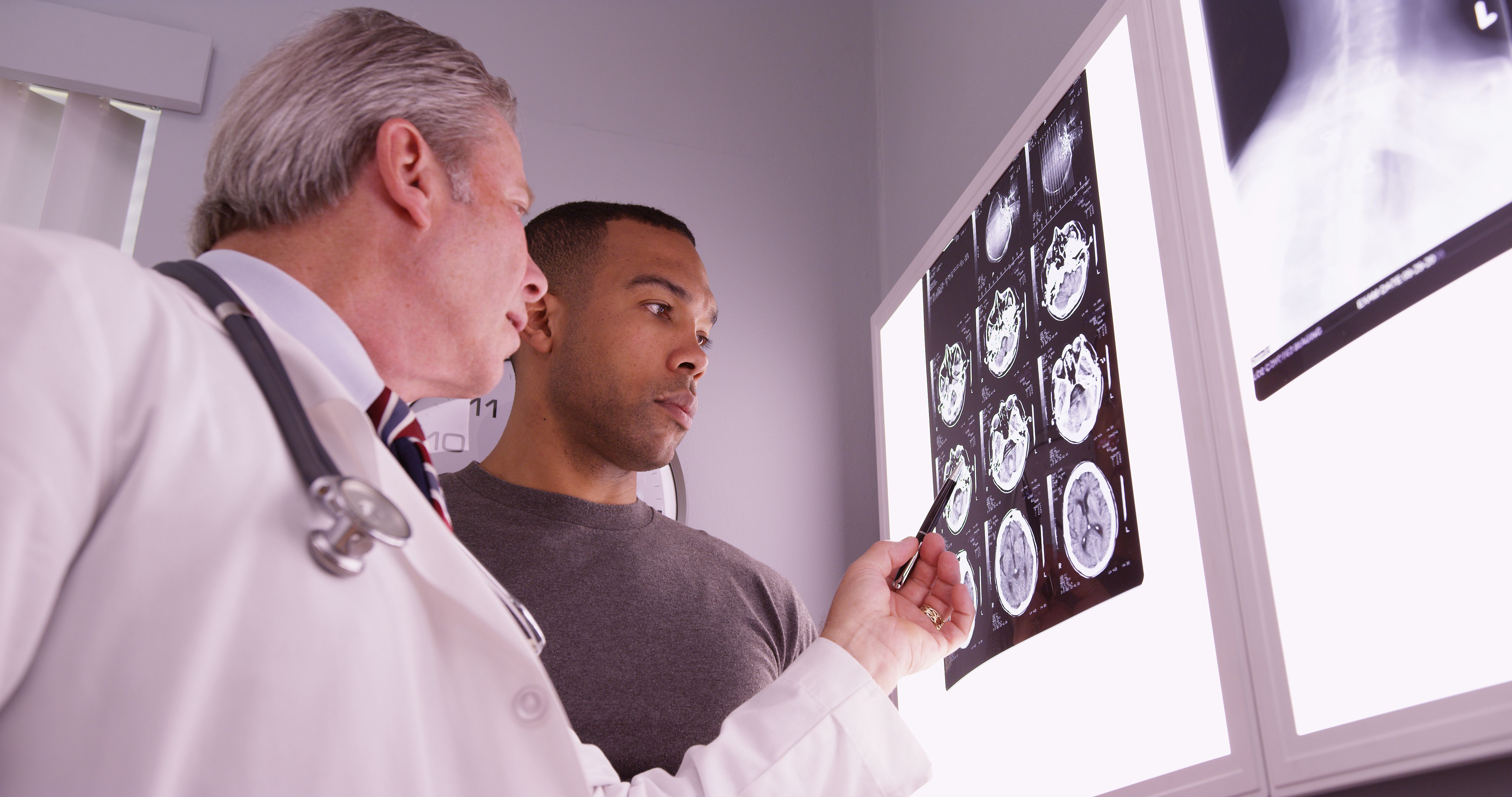 A clinician reviews brain scans with a patient