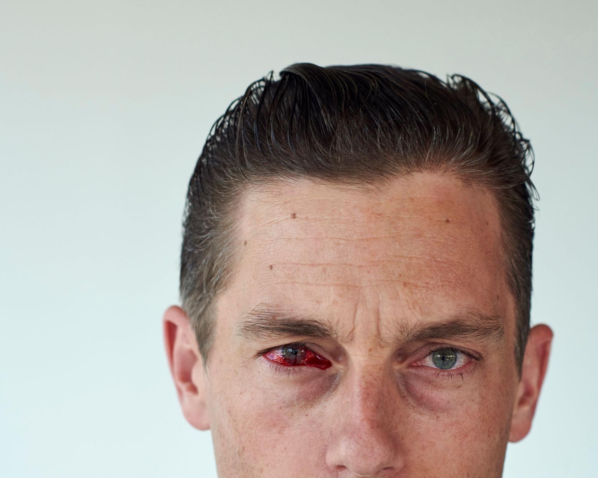 Volker Bruch, ANTI-HEARTTHROB