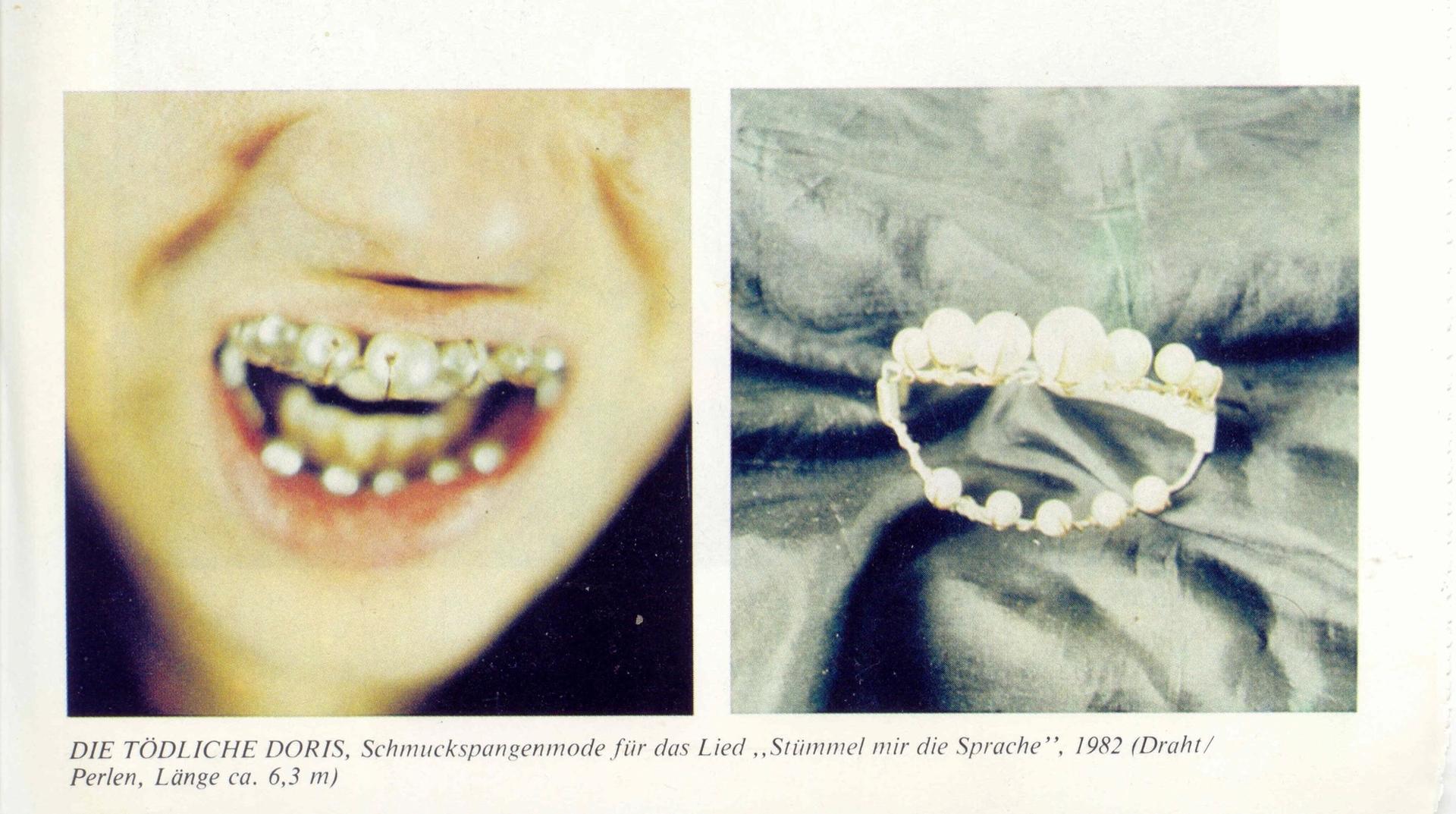 Schmuckzahnspange (Jewelry Implants)/Courtesy Wolfgang Müller/Archiv der Tödlichen Doris