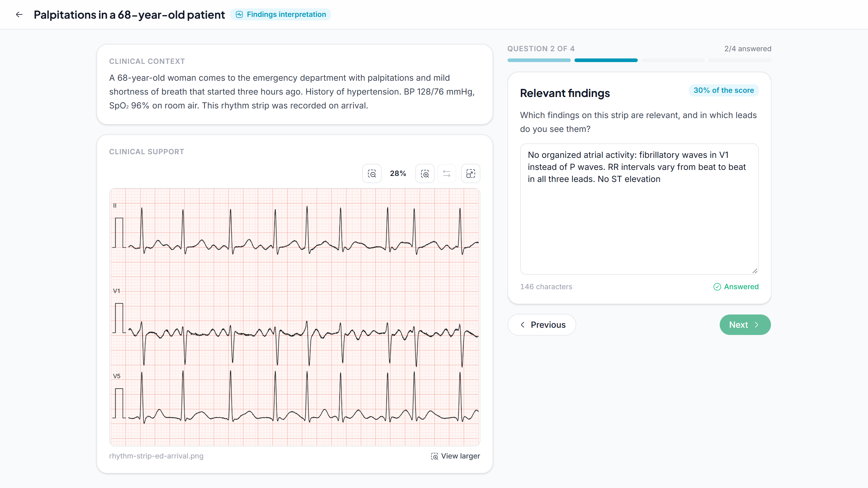 A student answering the relevant findings question of an ECG interpretation exercise, with the clinical context and a rhythm strip on the left