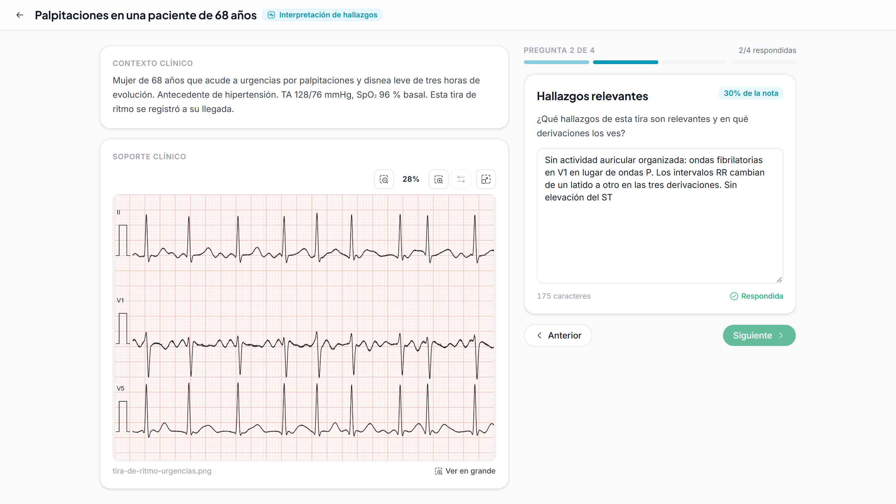 Un alumno responde a la pregunta de hallazgos relevantes de un ejercicio de interpretación de ECG, con el contexto clínico y la tira de ritmo a la izquierda