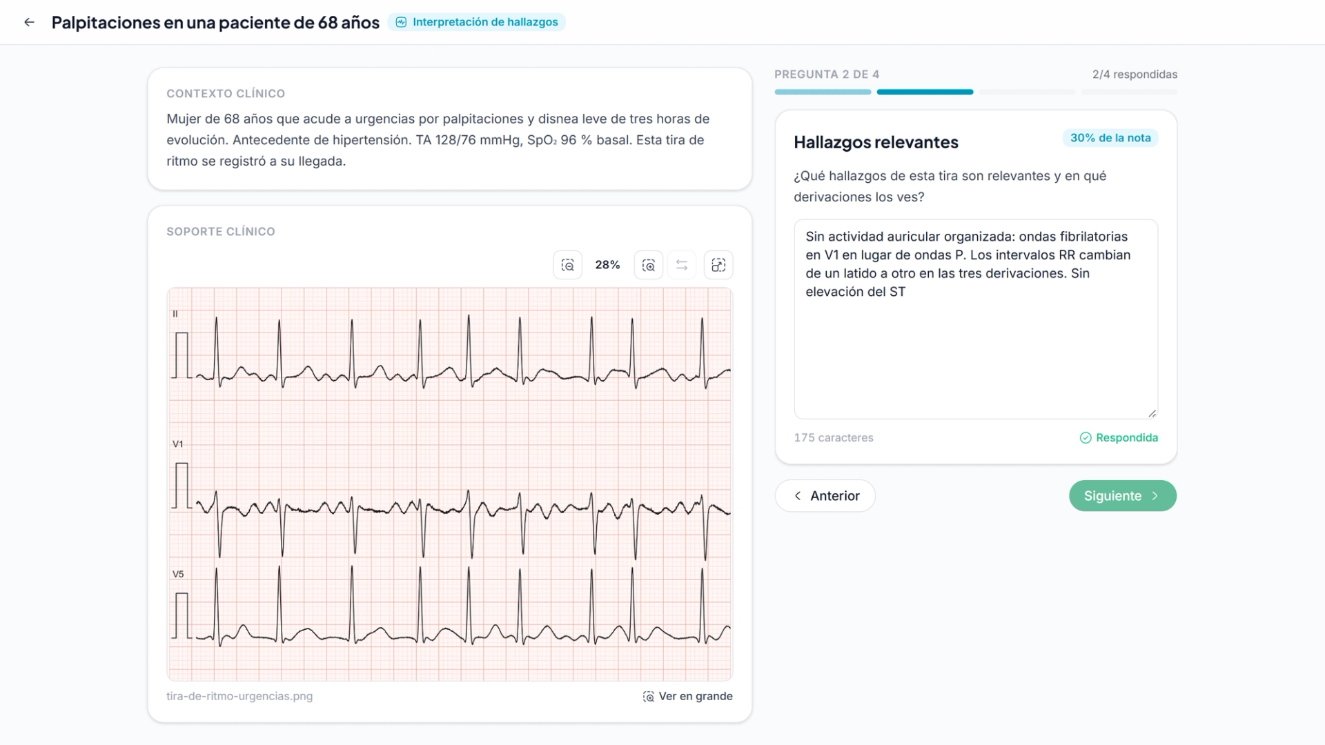 Un alumno responde a la pregunta de hallazgos relevantes de un ejercicio de interpretación de ECG, con el contexto clínico y la tira de ritmo a la izquierda