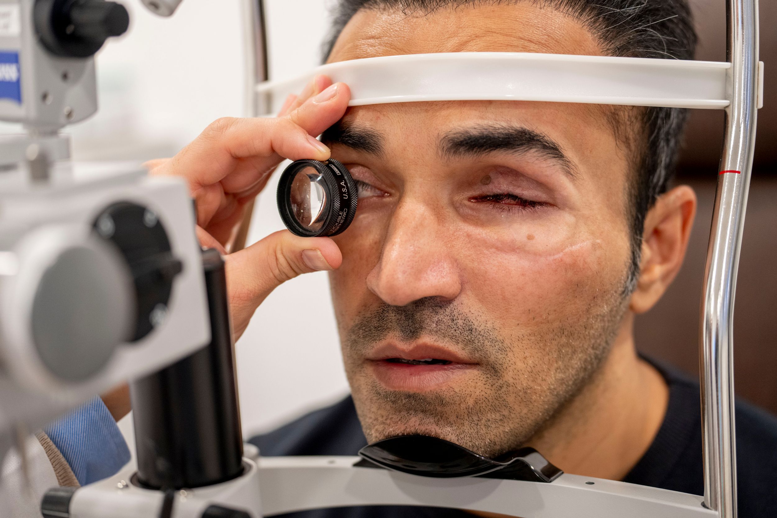 Showing treatment for eye injury on iranian who was shot in the eye