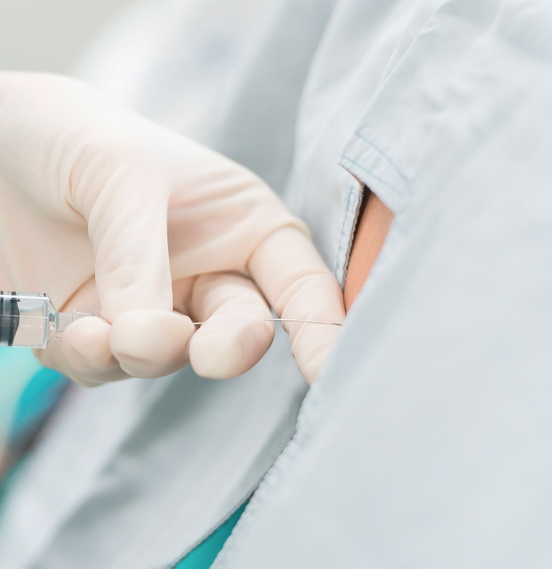 radiofrequency ablation radiofrequency ablation