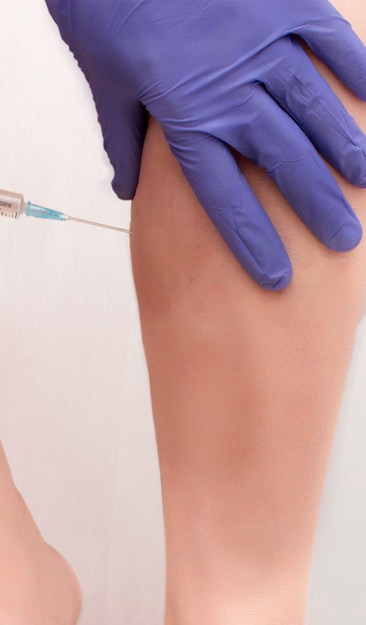 Sclerotherapy being done on patients leg