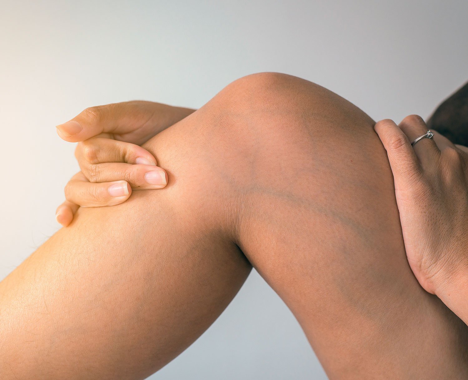 varicose veins treatment varicose veins treatment