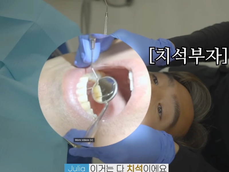 토론토 치과 실제 환자 틱톡 인플루언서