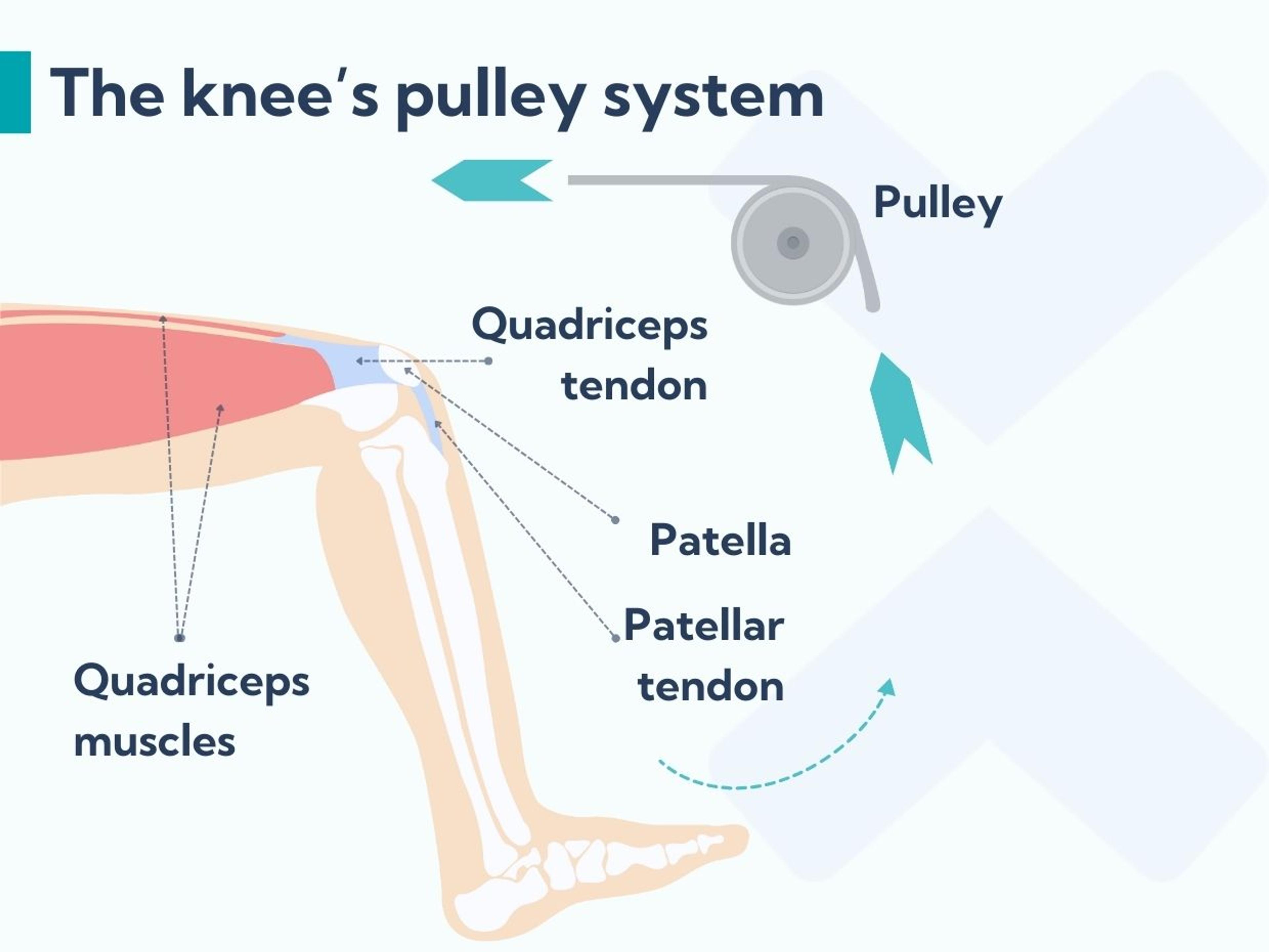 The patellar tendon forms part of the knee's pulley system and this is affected when you have patellar tendonitis.