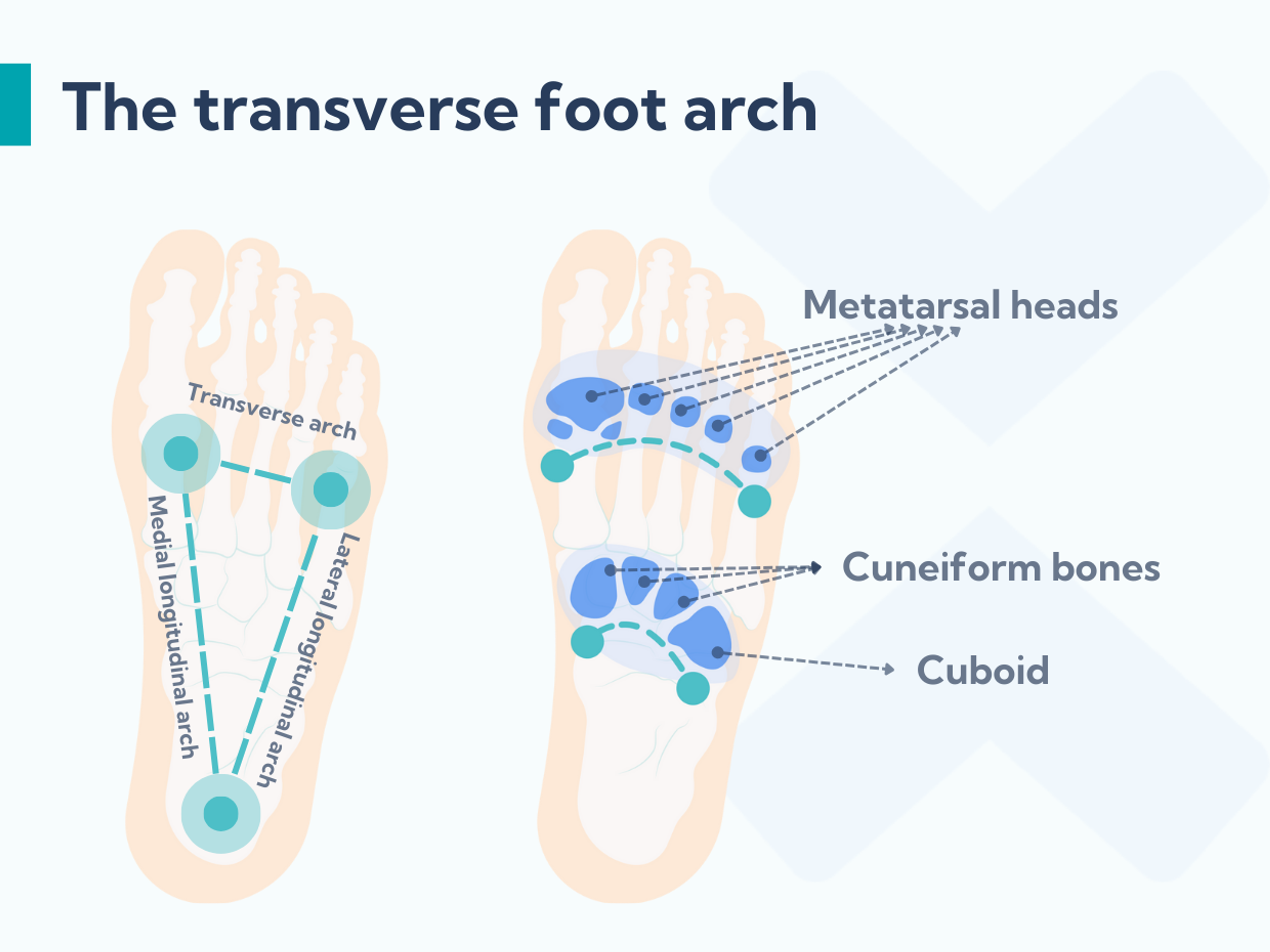 The transverse arch of the foot runs across the width of the foot.