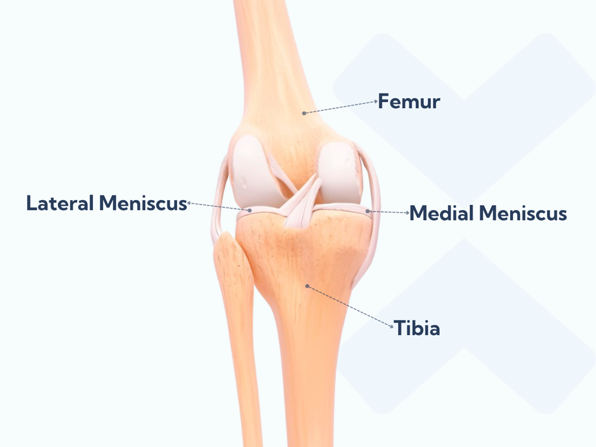 An Overview Of Meniscus Tears Causes Symptoms Diagnosis And Treatment Options 5847