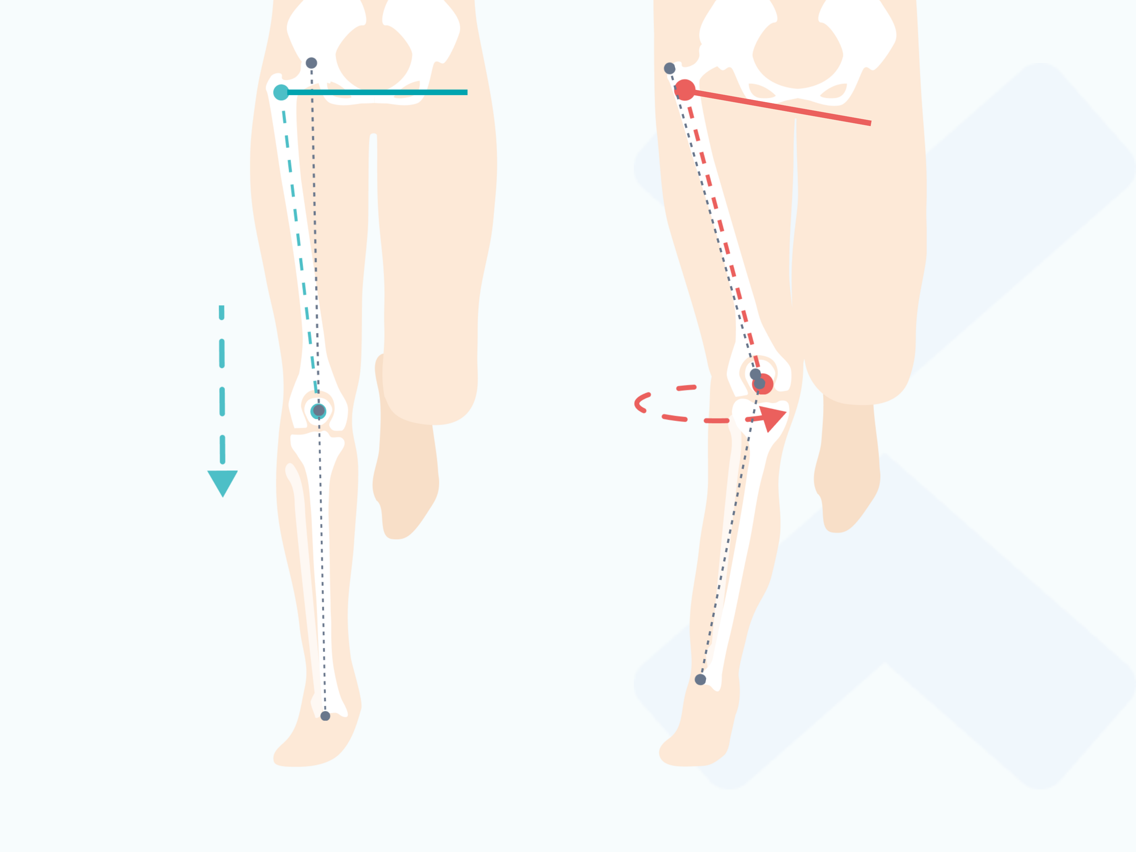 Perfect your running form — common mistakes that lead to injury