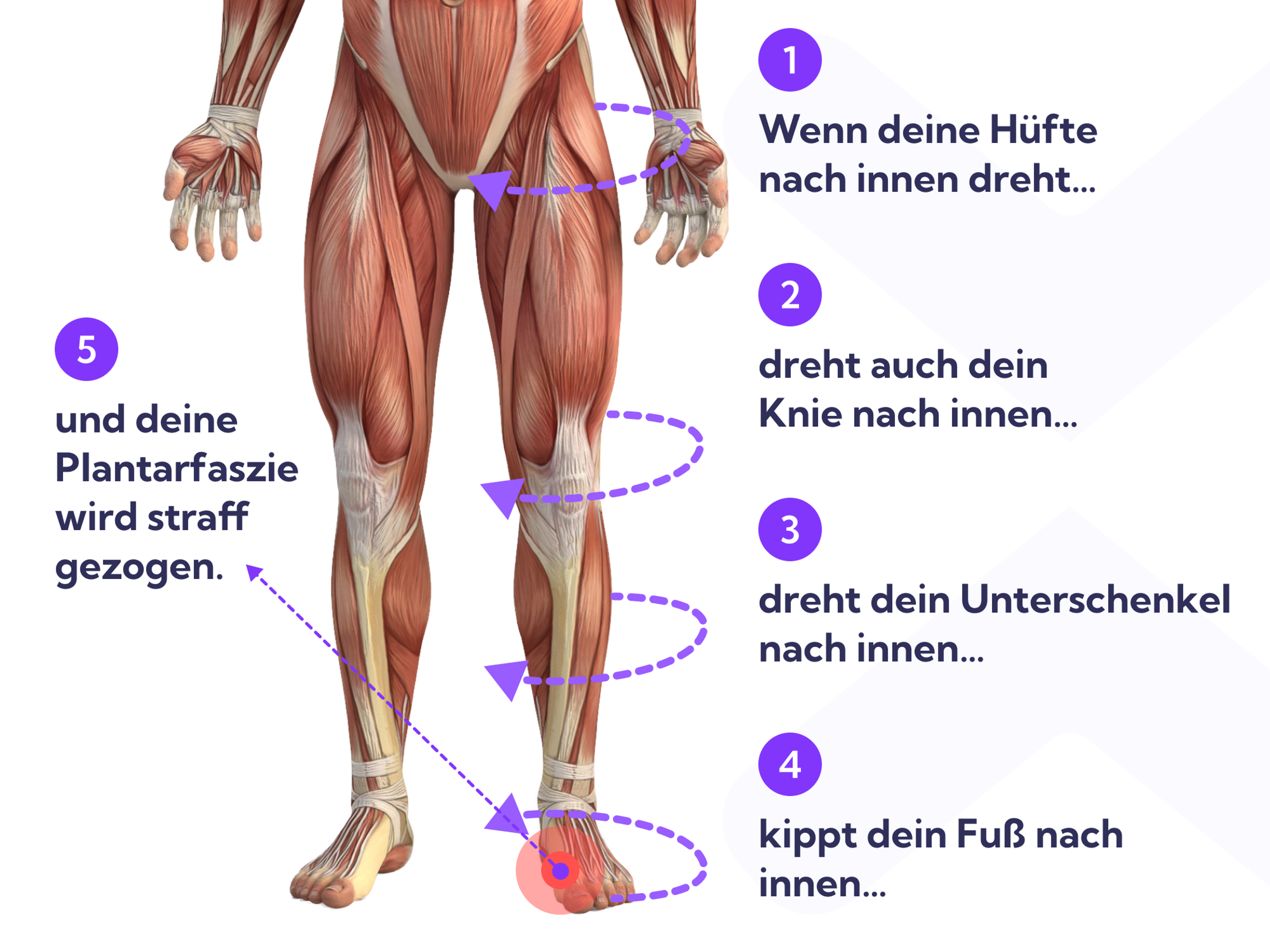 Fehlende Muskelkraft und ungünstige Bewegungsmuster können dazu führen, dass deine Plantarfaszie überlastet wird.