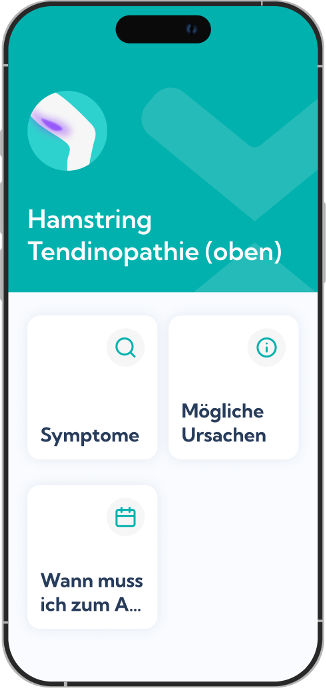 Hamstring Tendinopathie oben - Plan Übersicht Screen in der Exakt App