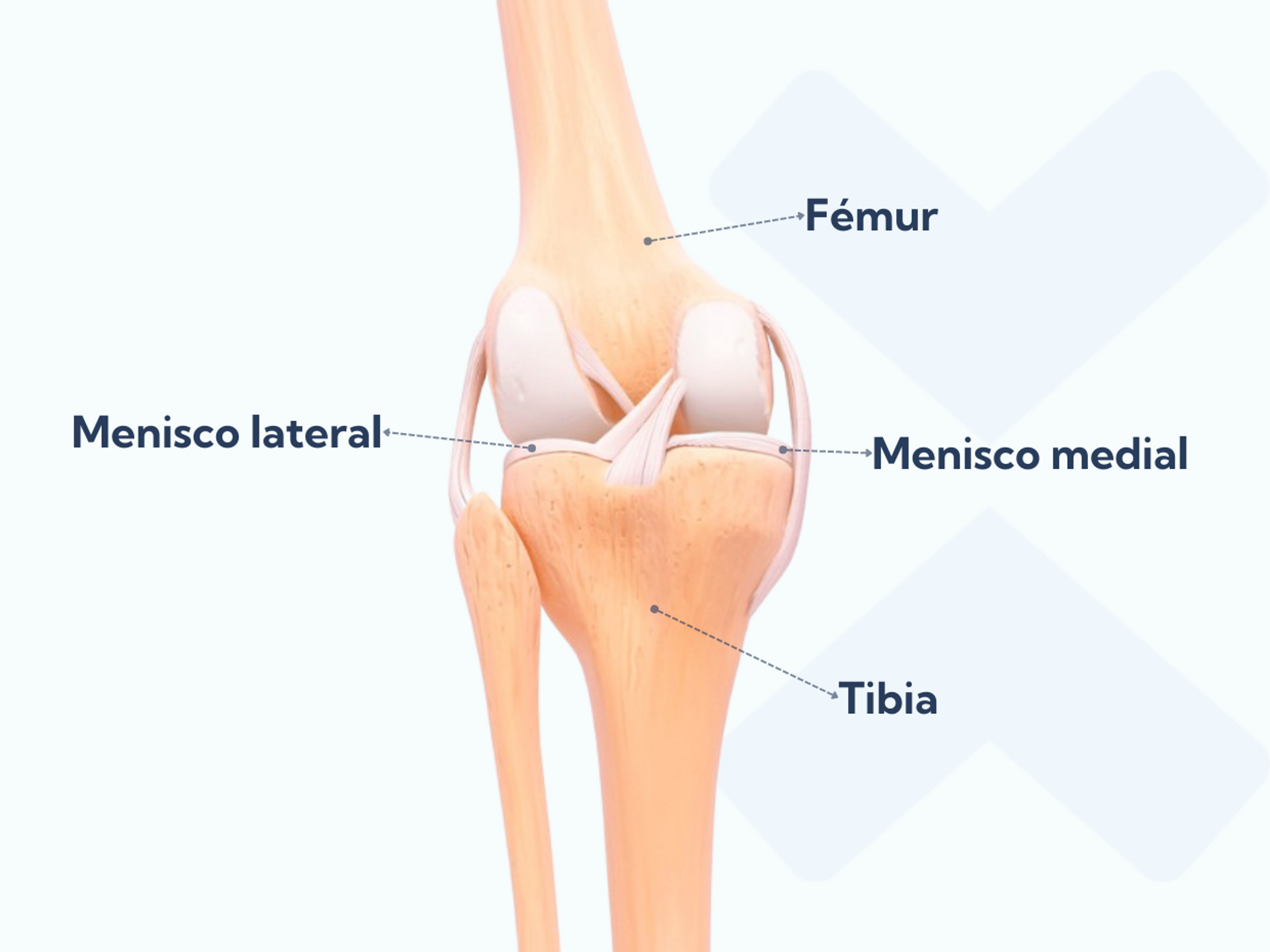 Anatomía de la articulación de la rodilla donde se muestran los meniscos medial y lateral