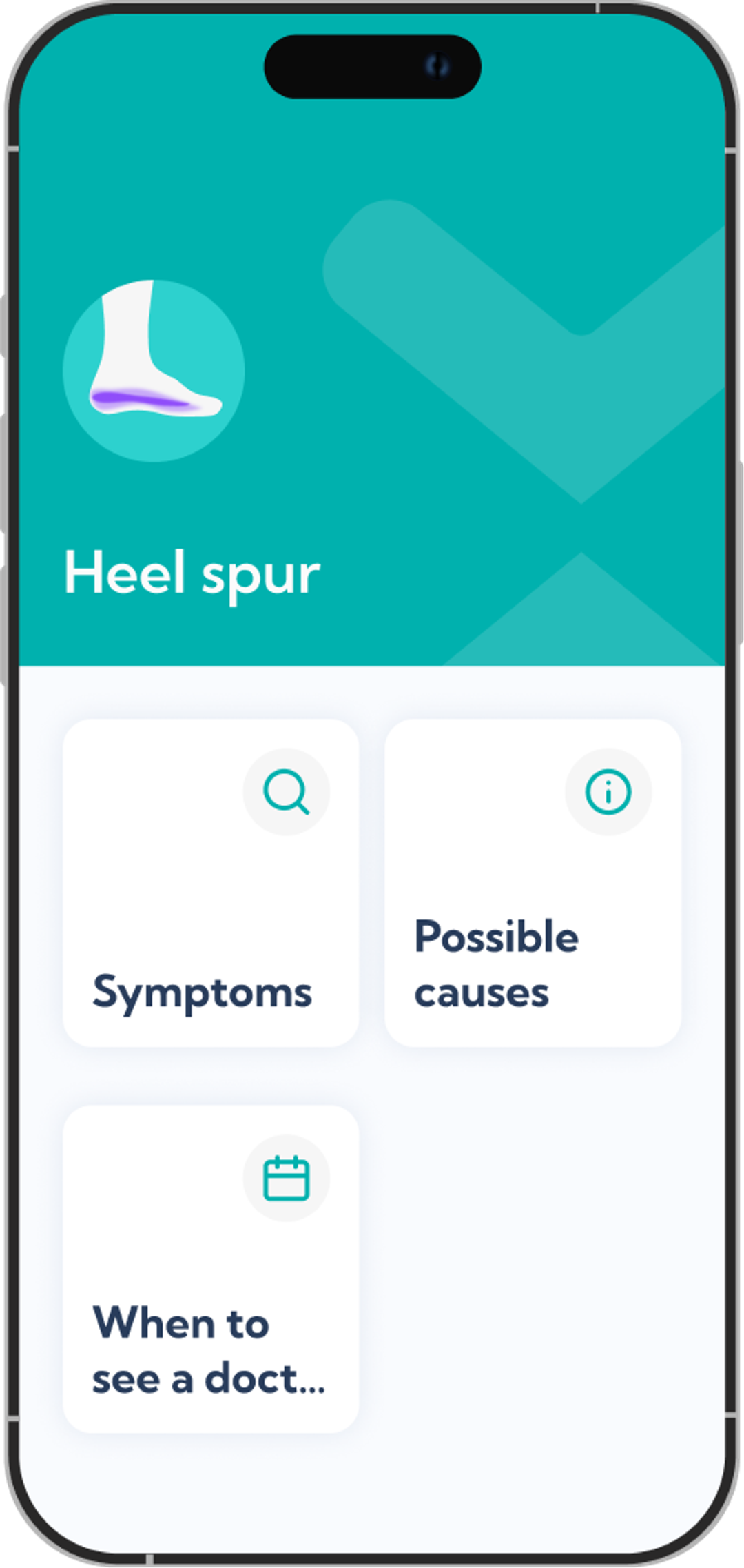 Screenshot of the Exakt app's Heel Spur Treatment plan overview screen.
