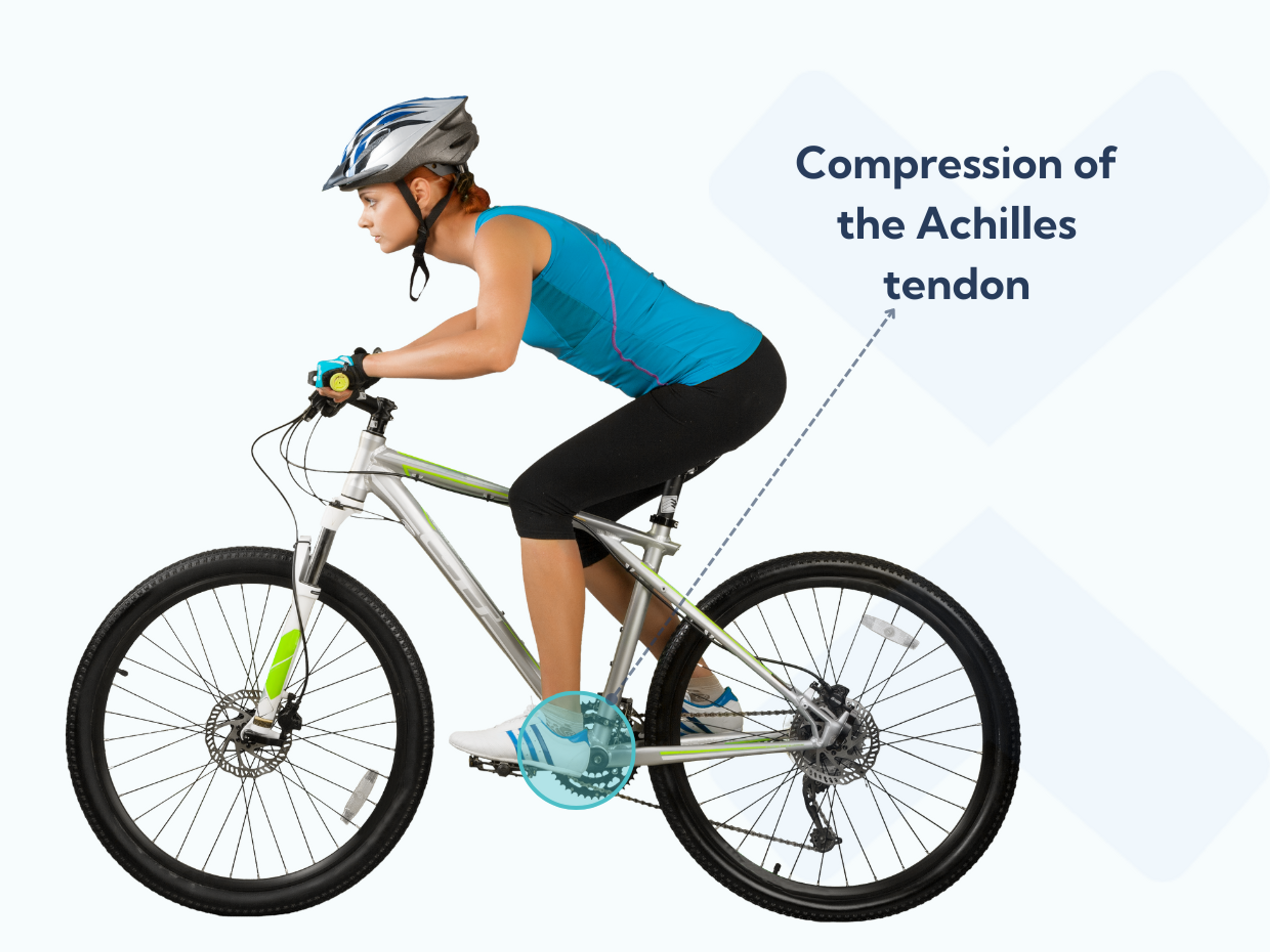 Some people with Achilles tendonitis find that cycling increases their pain.