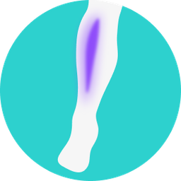 shin splints icon