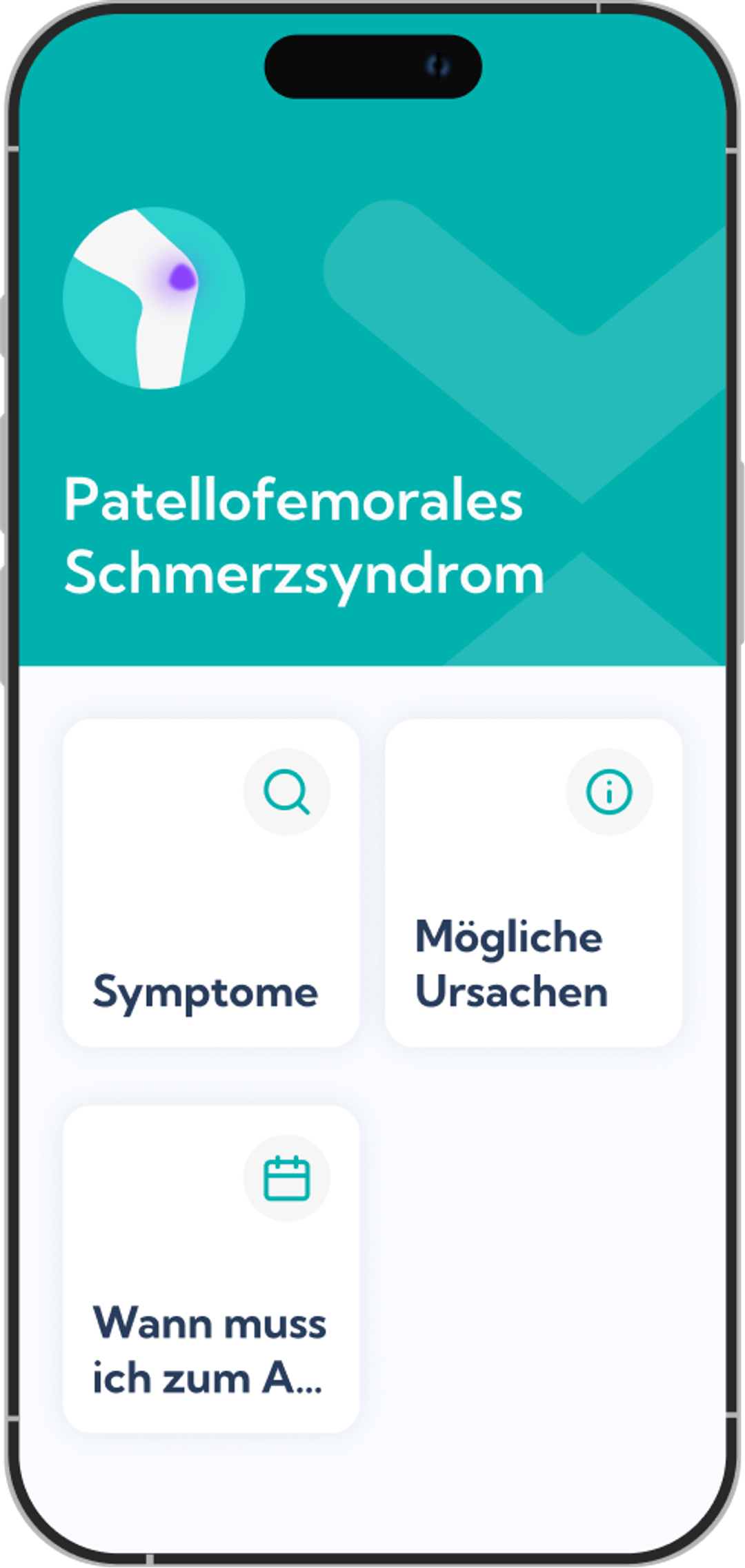 Patellofemorales Schmerzsyndrom Reha-Plan Übersicht in der Exakt App