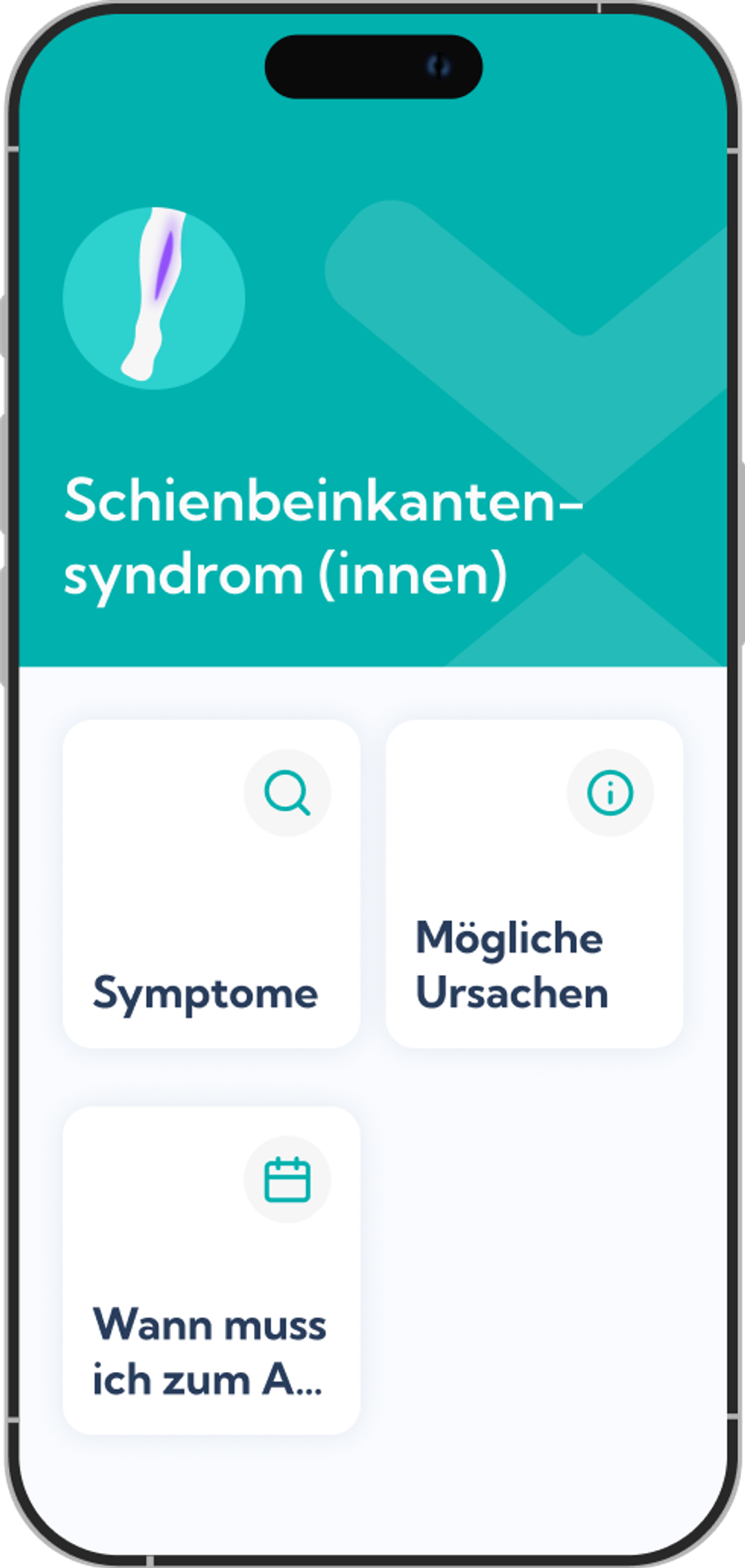 Inneres Schienbeinkantensyndrom Reha-Plan Übersicht in der Exakt App