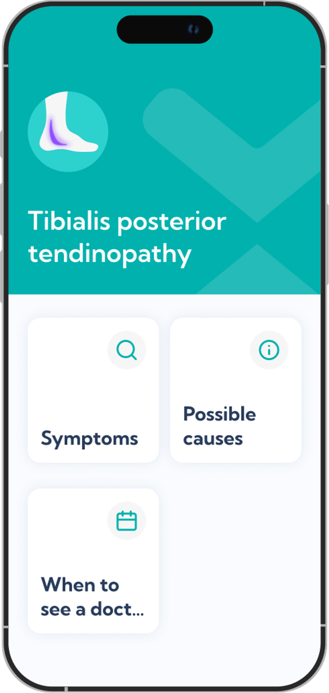 Tibialis posterior tendinopathy plan overview screen in the Exakt app.