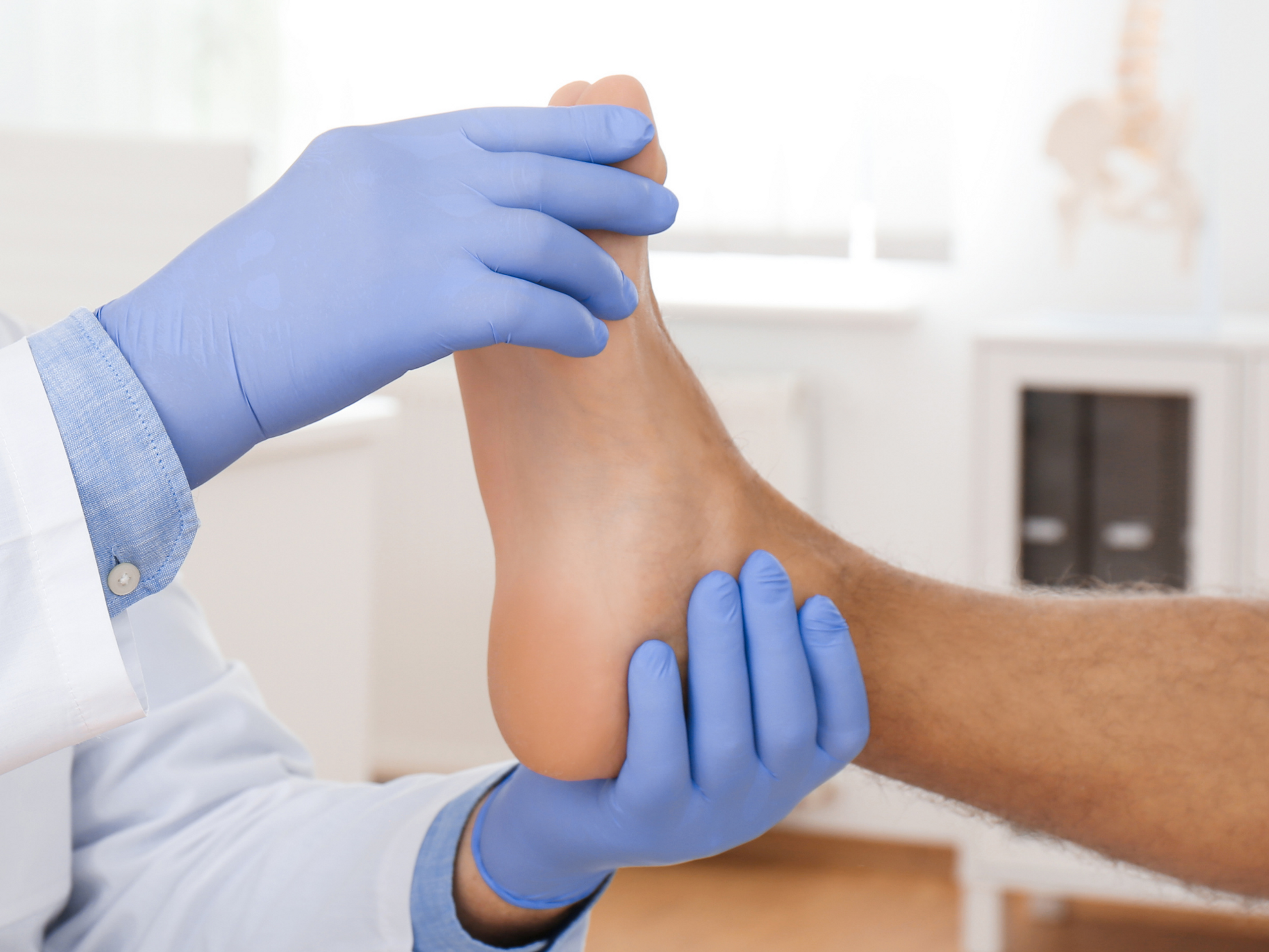 Surgery for plantar fasciitis