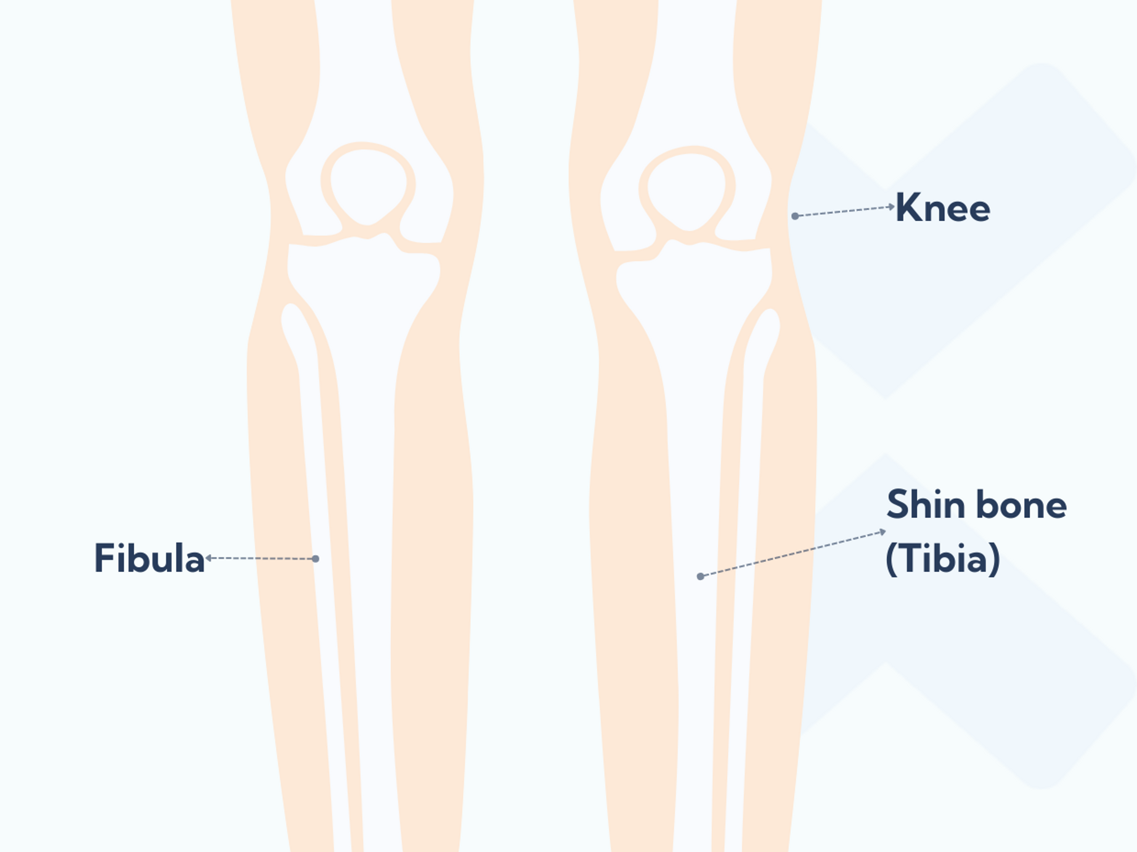 A runner's guide to medial shin splints: Causes, treatments and ...