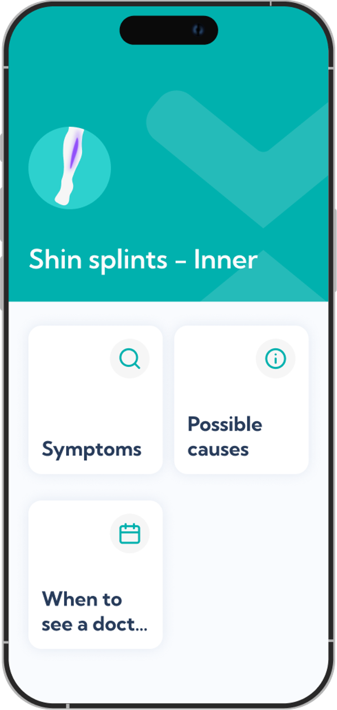 Medial shin splints plan overview screen in the Exakt app.