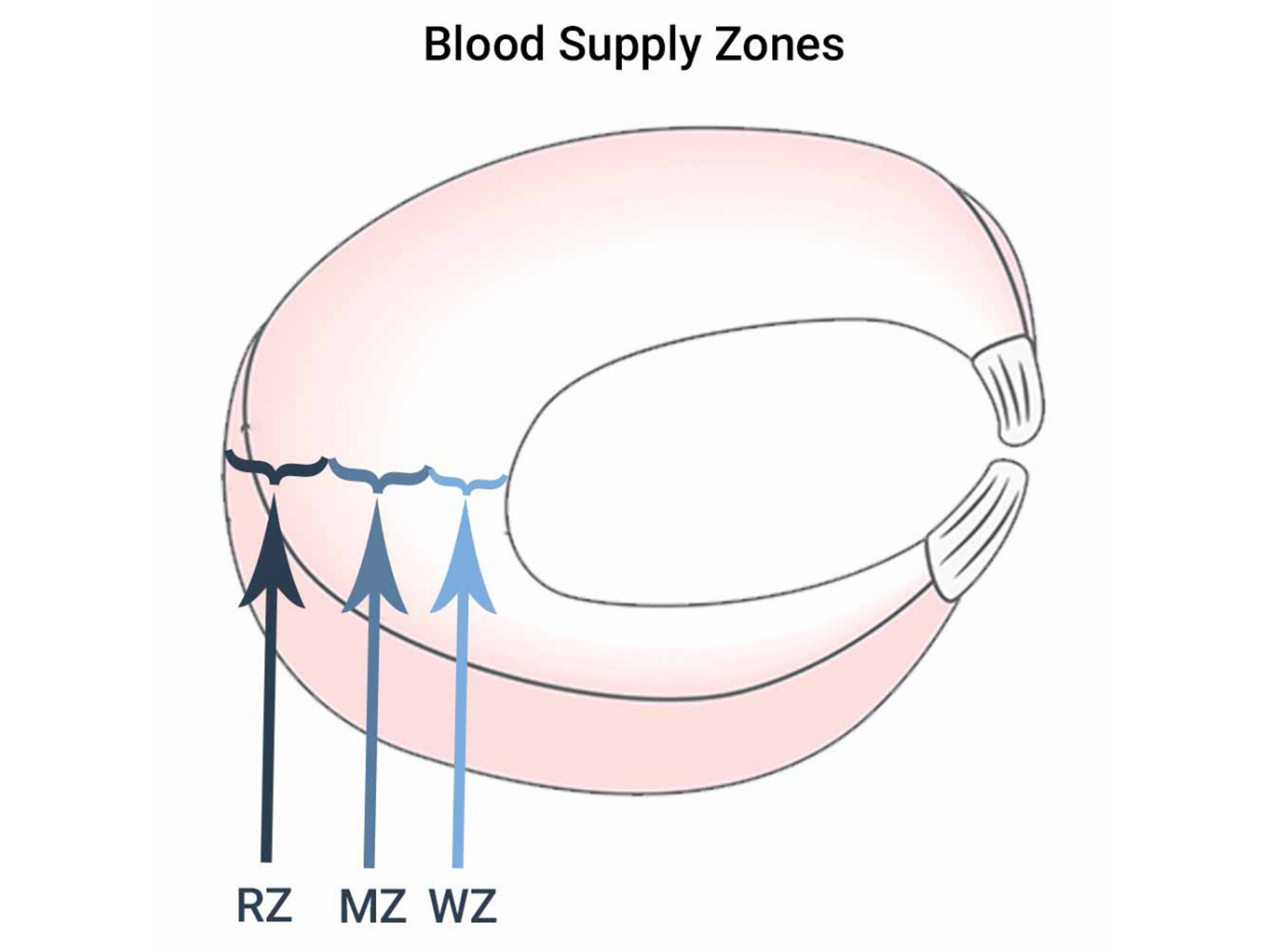 The outer edge of a meniscus has a better blood supply than the inner part and therefor more likely to heal.