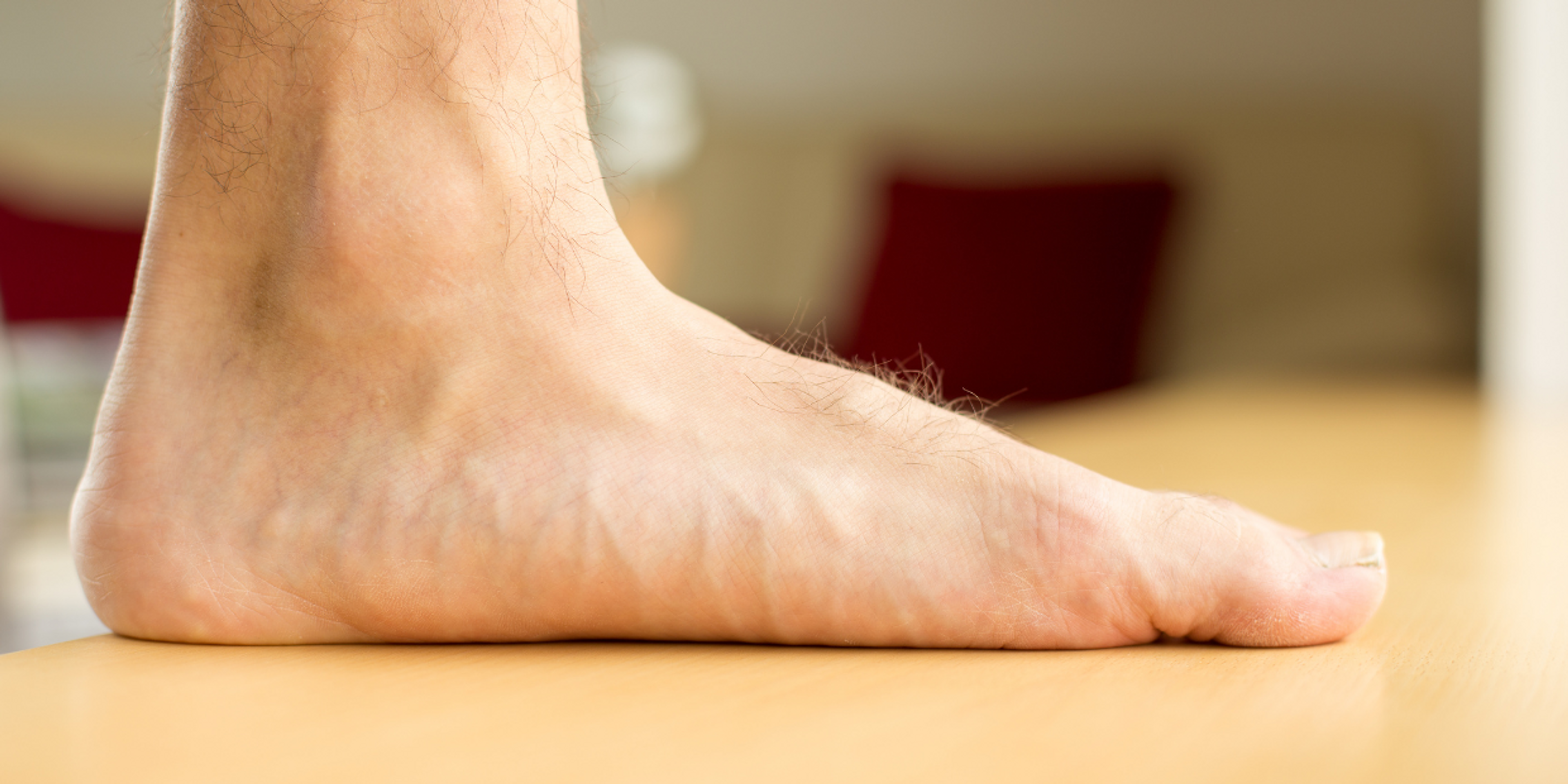 Flat feet can predispose you to developing plantar fasciitis and you may benefit from custom insoles if you have this foot shape.