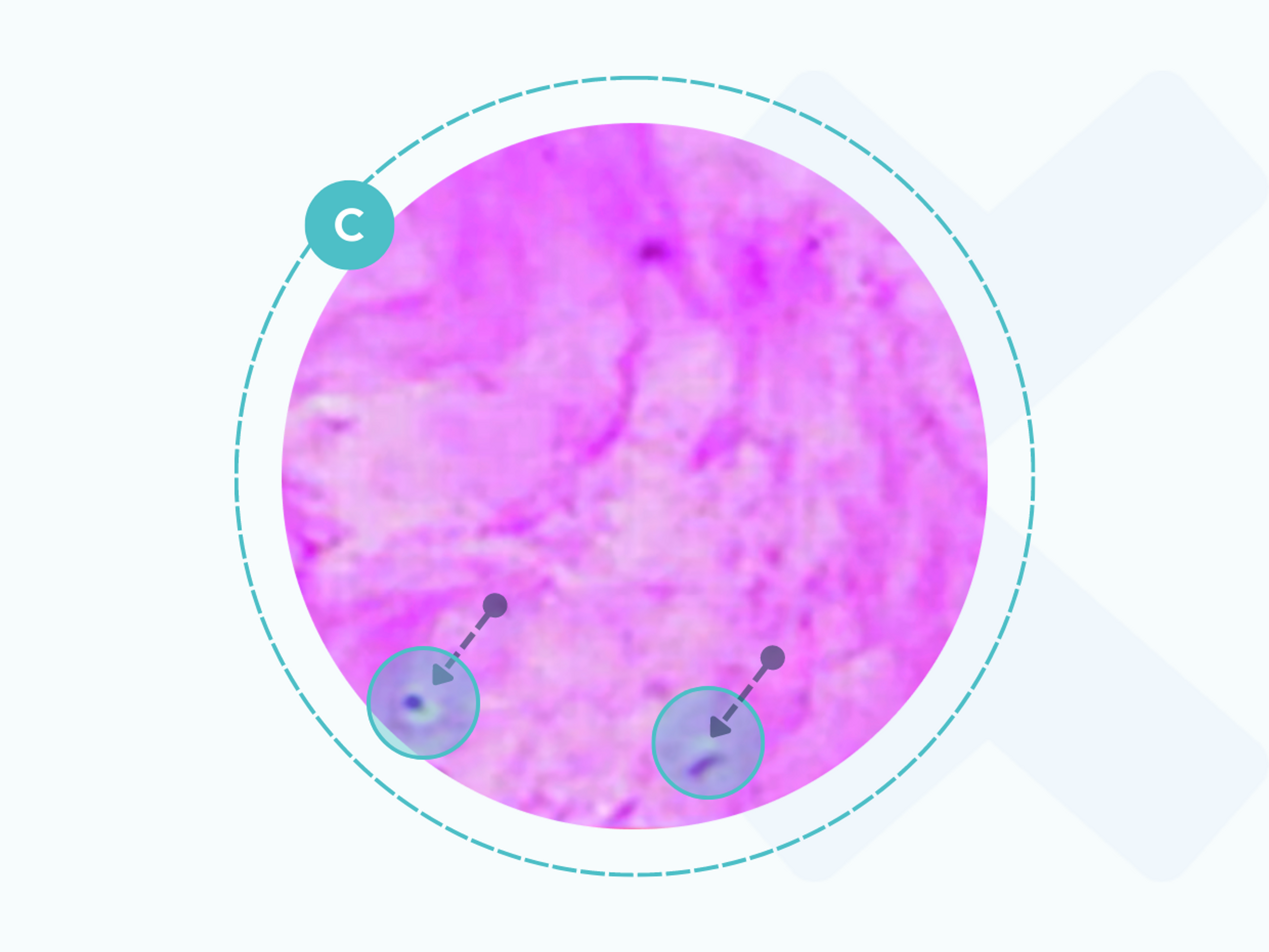 Bei einer Sehnenentzündung bewegen sich die Kollagenfasern voneinander weg und der Verband löst sich auf. Es gibt verschiedene Möglichkeiten, das zu behandeln.