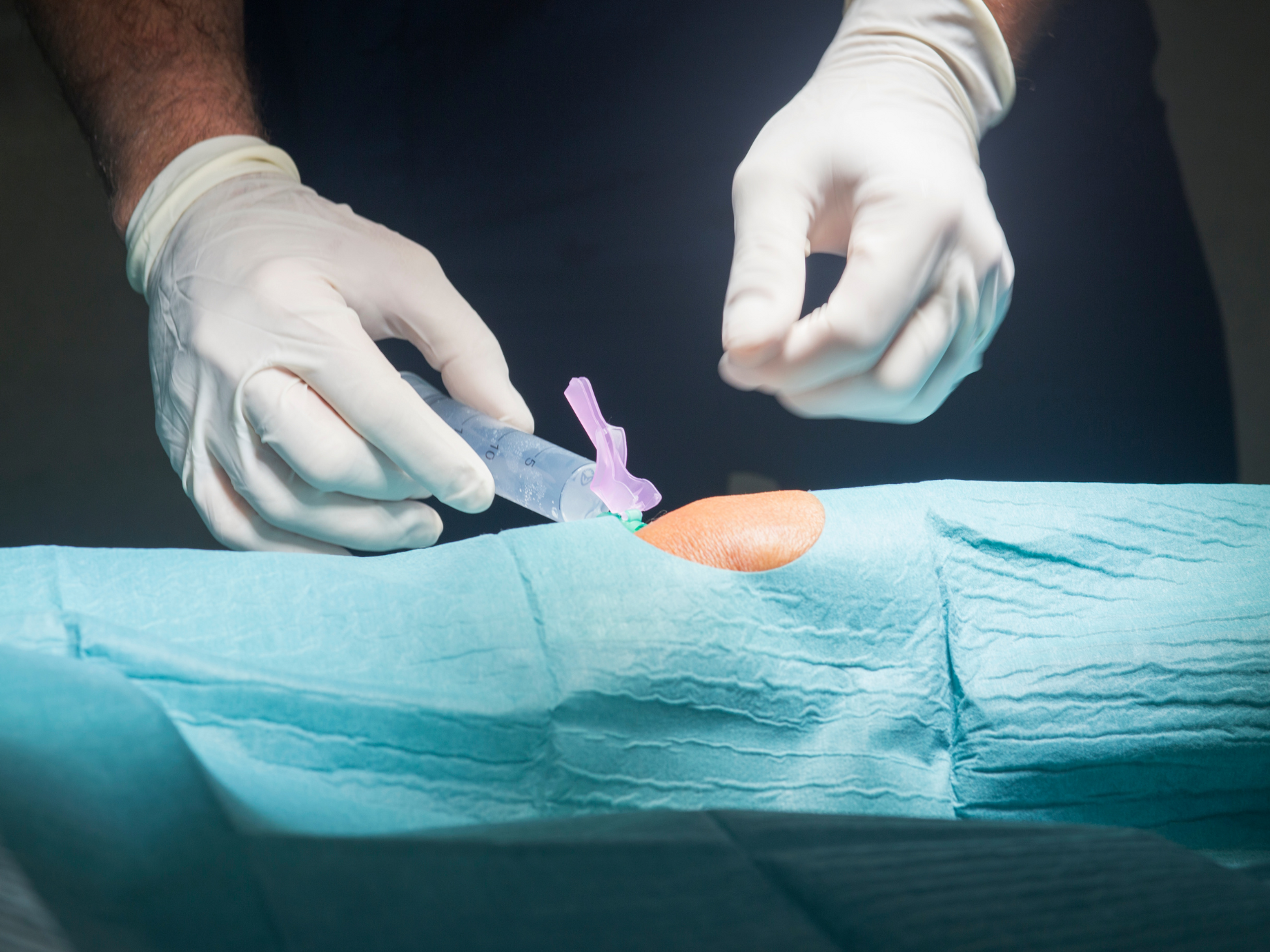 Invasive treatment options for patellar tendonitis include injections and surgery.
